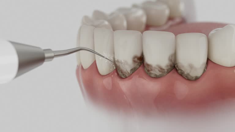 Reliable Dental contractor in Minot, ND by Smile Center Dentistry